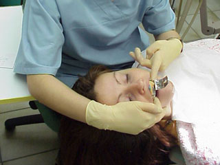 Zahnarzt München: Zahnschiene als Schutz vor Knirschen Zahnabrasion