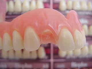 Zahn weg Zahnarzt München: kein Problem kommen Sie möglichst vormittags und warten auf kleinere Zahnersatz Reparaturen