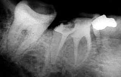 Zahnarzt München: die ganze Nacht Zahnschmerzen Notdienst